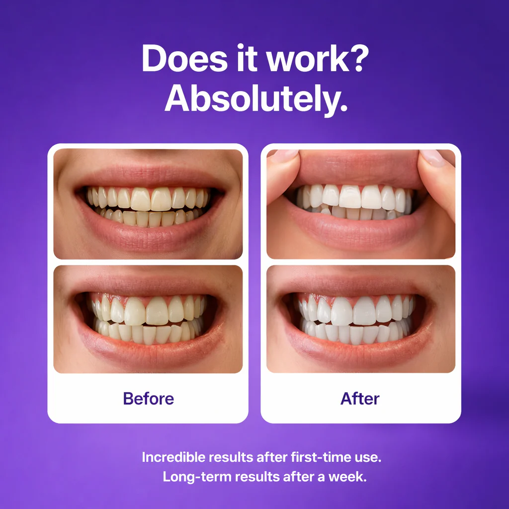 Teeth Whitening Strips – Fast Results, Zero Sensitivity 1pack(Buy 1 get 1 free)