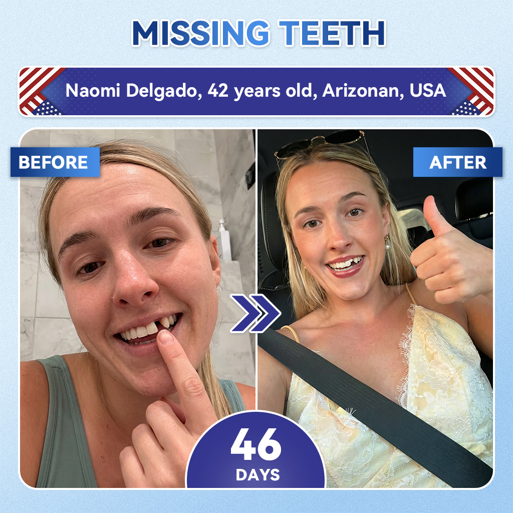 𝐇𝐞𝐚𝐥𝐫𝐢𝐳𝐞® 🦷 Tideglusib Fast‑Dissolving Tooth & Gum Repair Oral Strips ✨