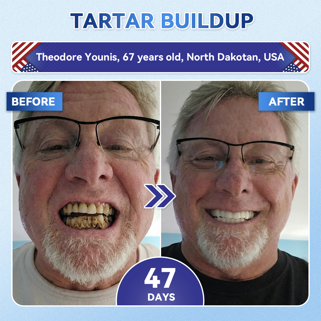 𝐇𝐞𝐚𝐥𝐫𝐢𝐳𝐞® 🦷 Tideglusib Fast‑Dissolving Tooth & Gum Repair Oral Strips ✨