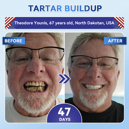 𝐇𝐞𝐚𝐥𝐫𝐢𝐳𝐞® 🦷 Tideglusib Fast‑Dissolving Tooth & Gum Repair Oral Strips ✨