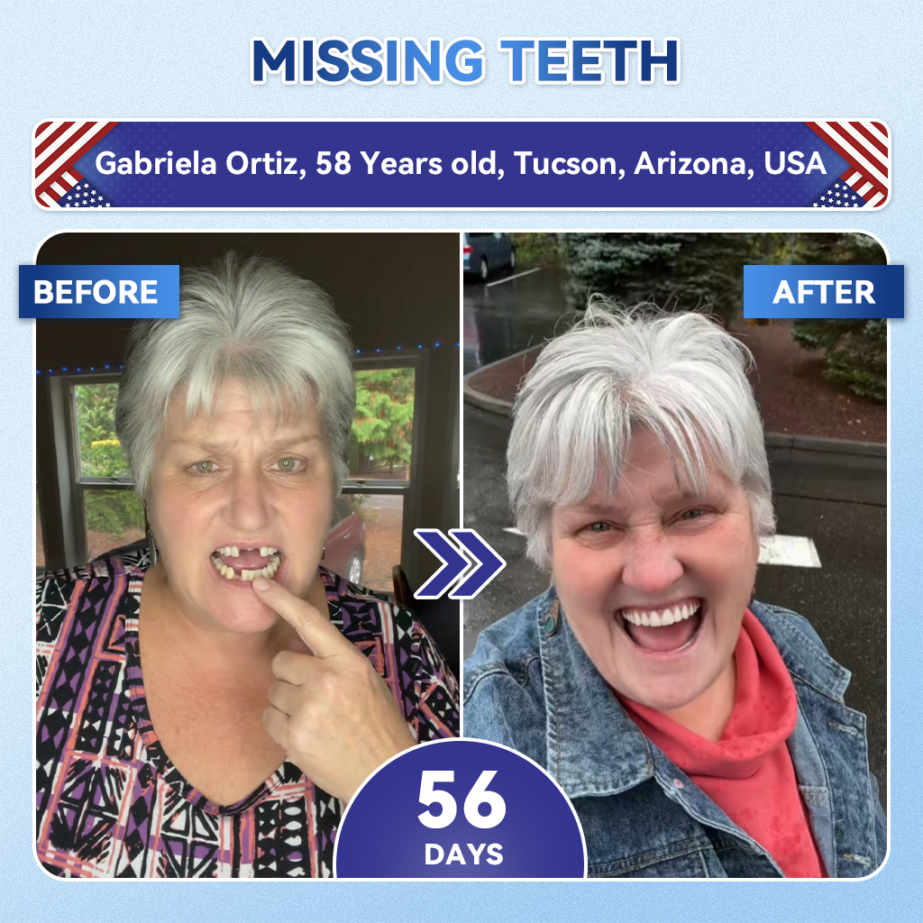 𝐇𝐞𝐚𝐥𝐫𝐢𝐳𝐞® 🦷 Tideglusib Fast‑Dissolving Tooth & Gum Repair Oral Strips ✨