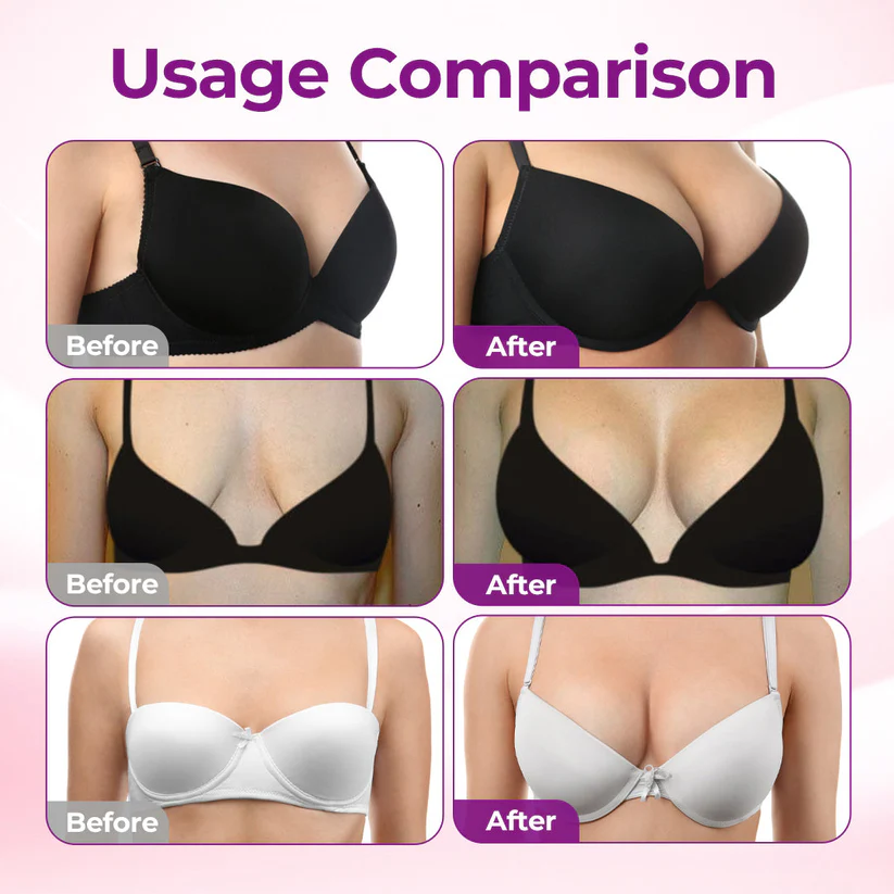 👍🏻Alcuras® Targeted Breast Enhancement Advanced Nano Microneedle Patch👍🏻👍🏻👍🏻