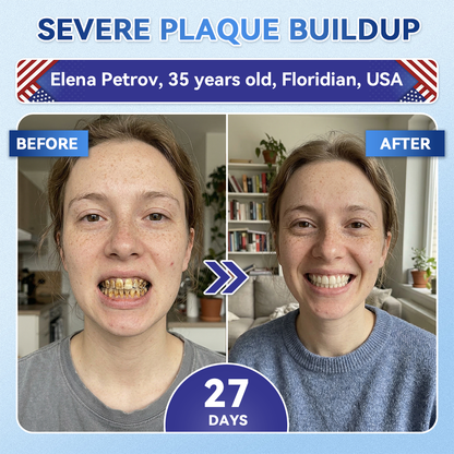 𝐇𝐞𝐚𝐥𝐫𝐢𝐳𝐞® 🦷 Tideglusib Fast‑Dissolving Tooth & Gum Repair Oral Strips ✨