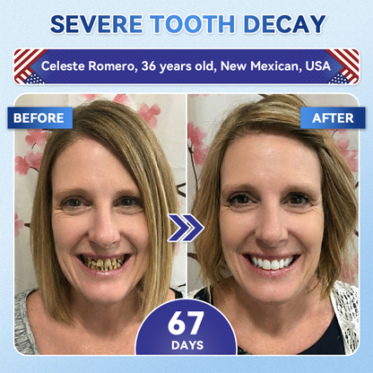 𝐇𝐞𝐚𝐥𝐫𝐢𝐳𝐞® 🦷 Tideglusib Fast‑Dissolving Tooth & Gum Repair Oral Strips ✨