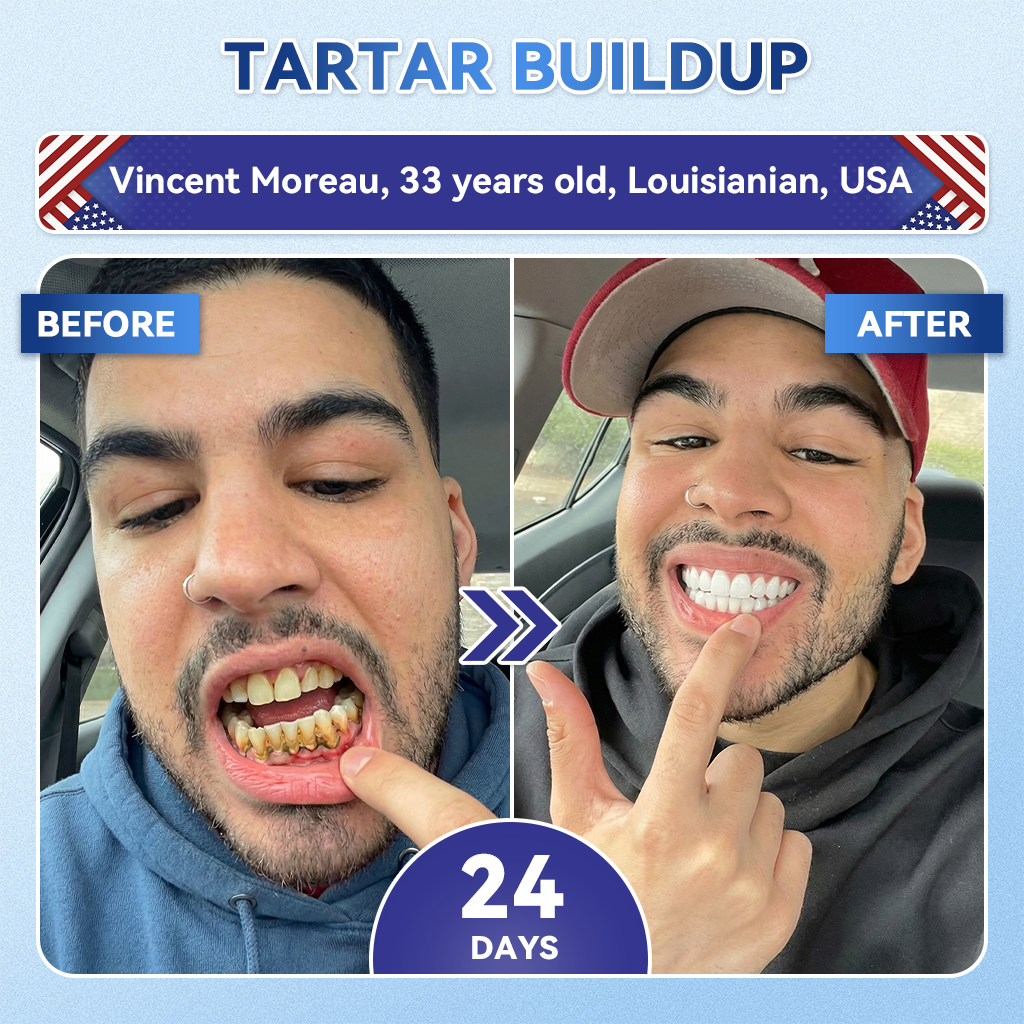 𝐇𝐞𝐚𝐥𝐫𝐢𝐳𝐞® 🦷 Tideglusib Fast‑Dissolving Tooth & Gum Repair Oral Strips ✨
