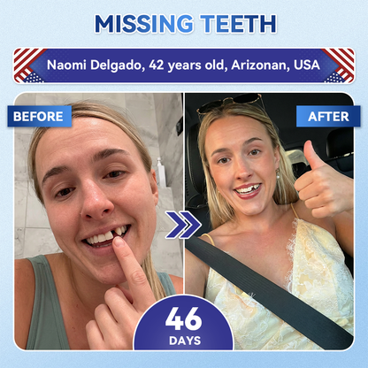 𝐇𝐞𝐚𝐥𝐫𝐢𝐳𝐞® 🦷 Tideglusib Fast‑Dissolving Tooth & Gum Repair Oral Strips ✨
